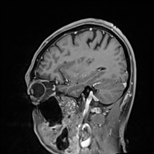 Click on the Serie image to view the images of VILLANUEVA, WILLIAM A.